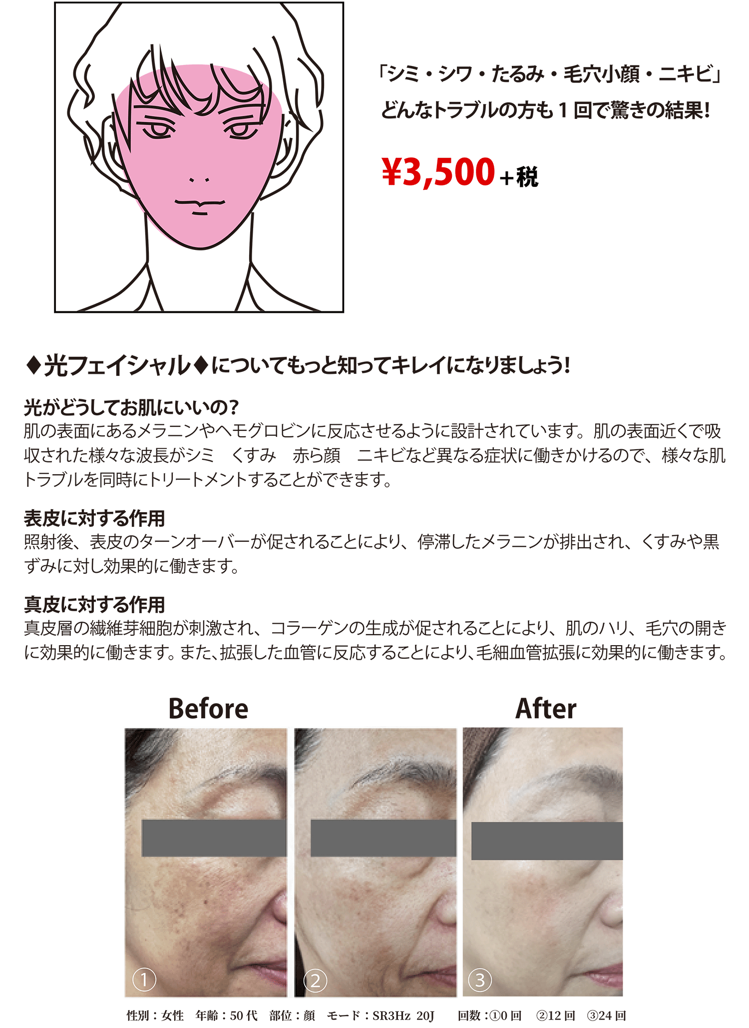 光フェイシャルメニュー